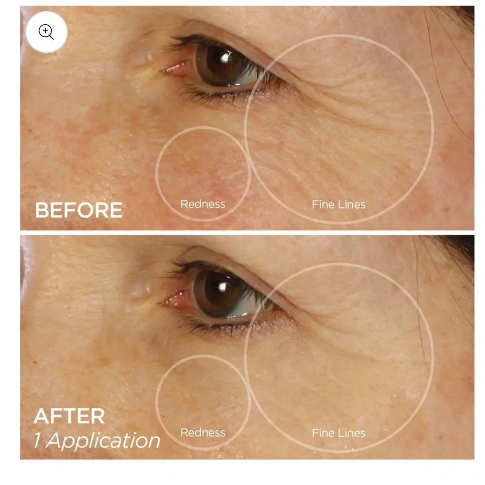 Eye Masks 🎉❤️ - Picture 5 of 6